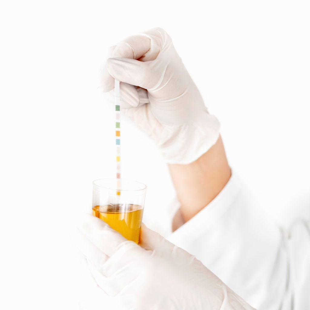 Veterinární analyzátor moči VECHEK™ VUR-200 – komplexní vyšetření moči